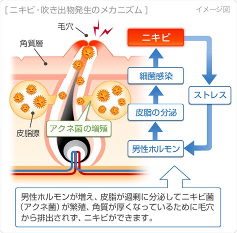 おなにー肌|オナニーし過ぎでニキビができる？おなニキビの原因と対処方法。